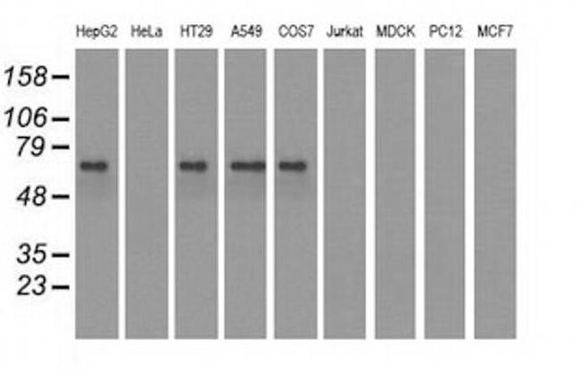 IGF2BP2 Antibody in Western Blot (WB)