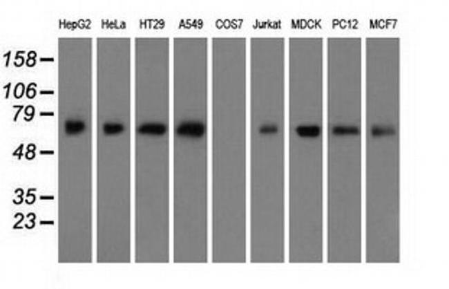 BMAL1 Antibody in Western Blot (WB)