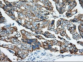 KHK Antibody in Immunohistochemistry (Paraffin) (IHC (P))