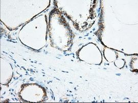 KHK Antibody in Immunohistochemistry (Paraffin) (IHC (P))