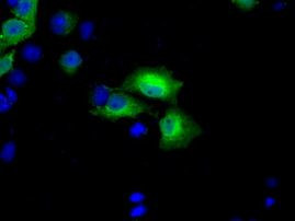 BDH2 Antibody in Immunocytochemistry (ICC/IF)