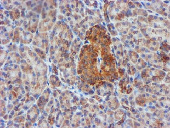 CYB5R3 Antibody in Immunohistochemistry (Paraffin) (IHC (P))