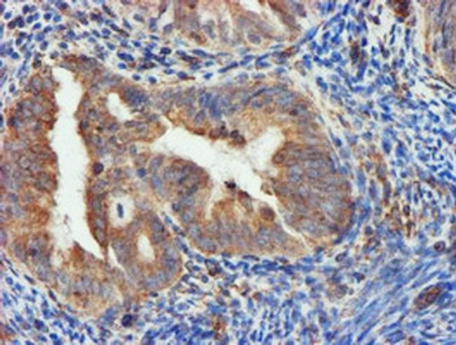 CYB5R3 Antibody in Immunohistochemistry (Paraffin) (IHC (P))