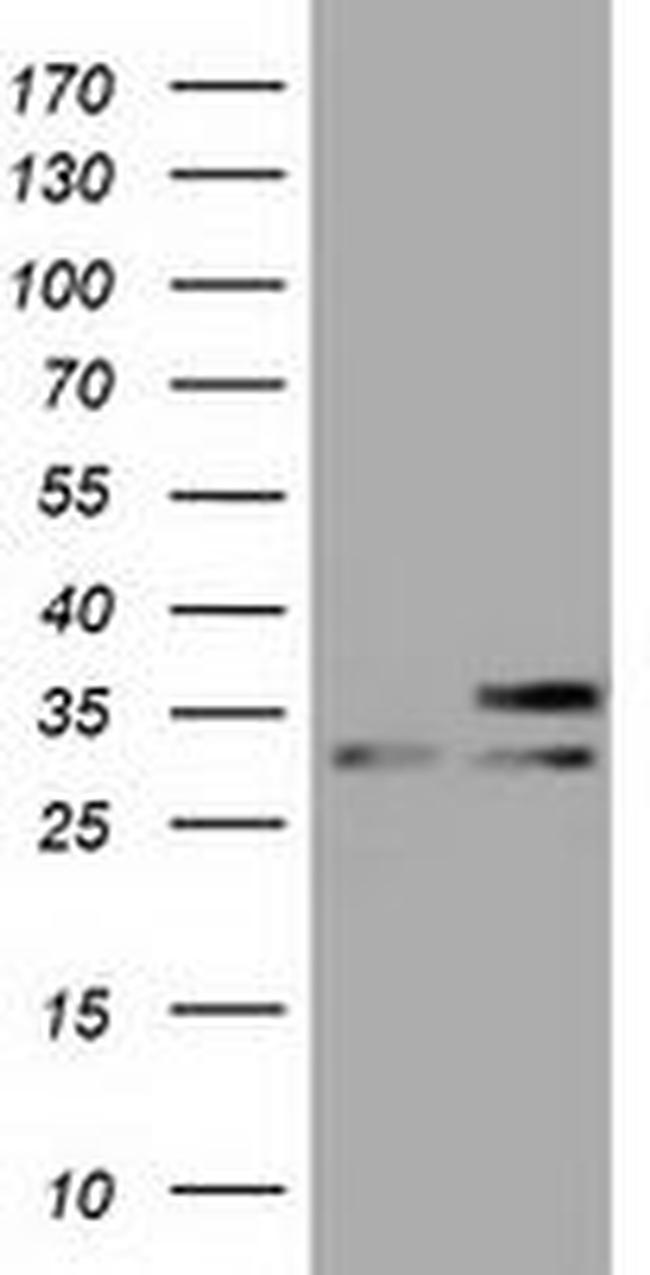 FHL1 Antibody in Western Blot (WB)