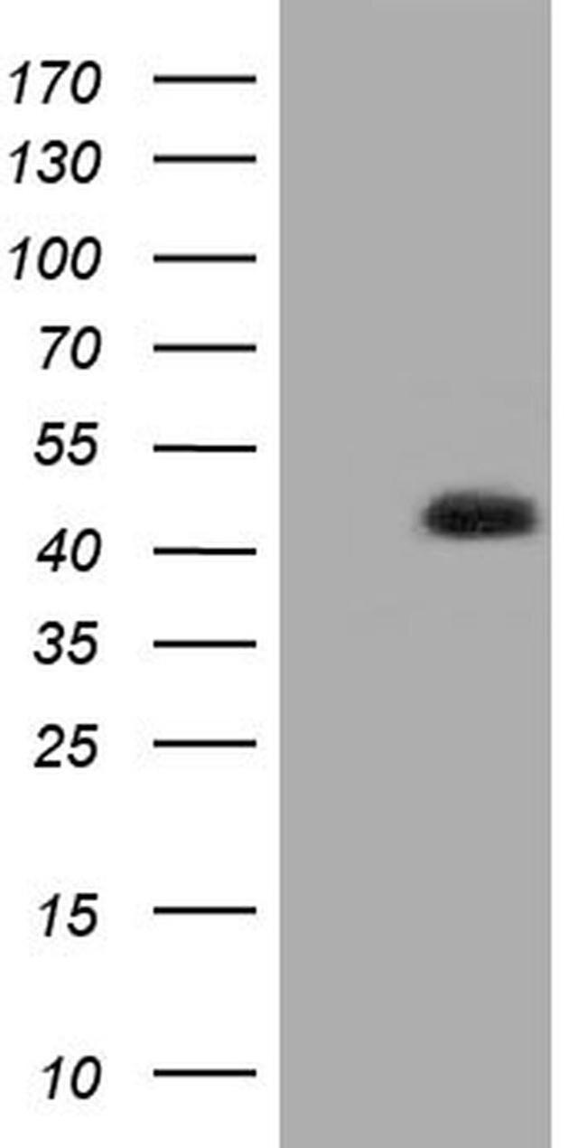 HIBCH Antibody in Western Blot (WB)