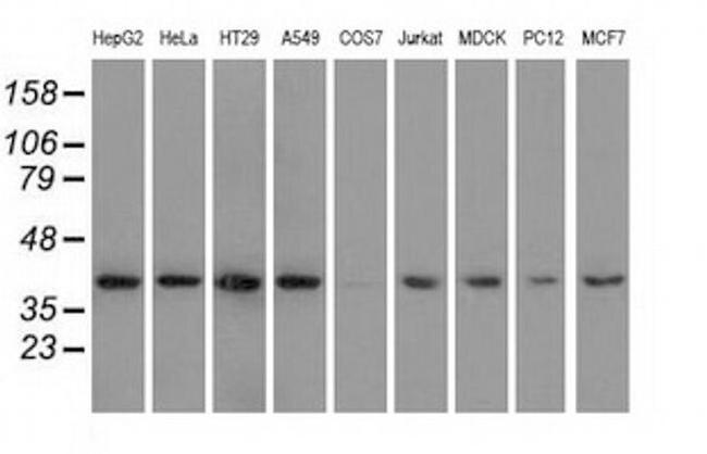 HIBCH Antibody in Western Blot (WB)