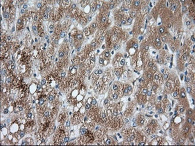 PANK2 Antibody in Immunohistochemistry (Paraffin) (IHC (P))