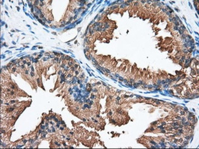 PANK2 Antibody in Immunohistochemistry (Paraffin) (IHC (P))