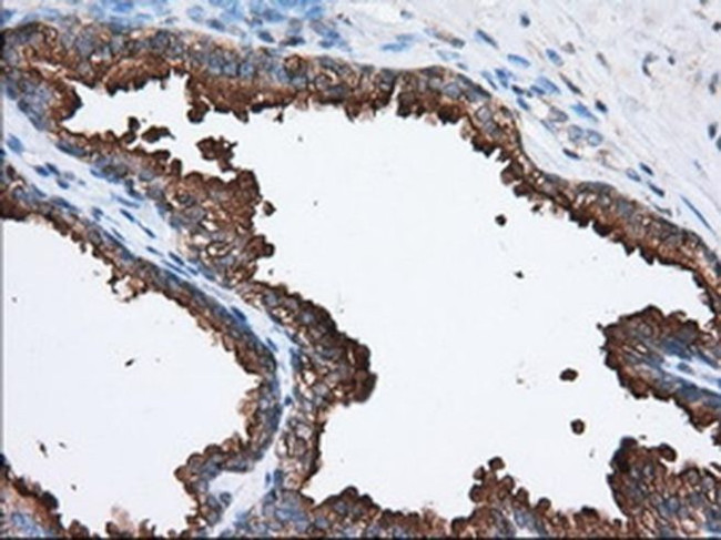 PANK2 Antibody in Immunohistochemistry (Paraffin) (IHC (P))