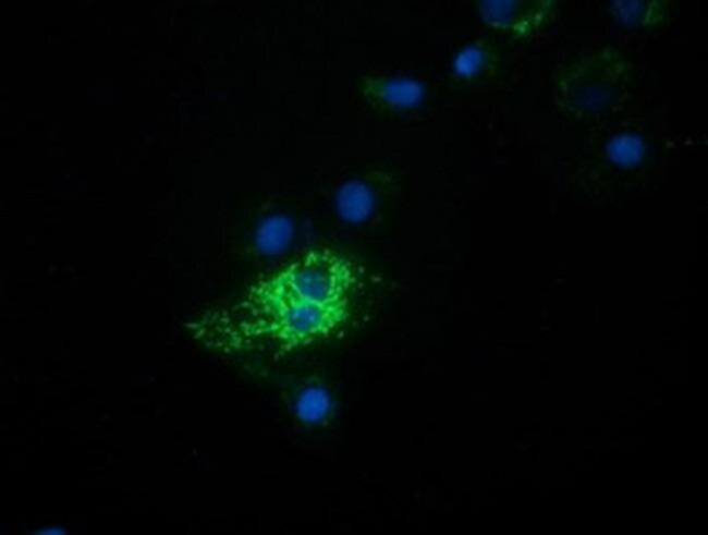 HIBCH Antibody in Immunocytochemistry (ICC/IF)