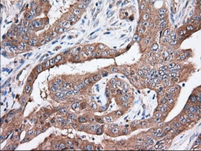 TTC32 Antibody in Immunohistochemistry (Paraffin) (IHC (P))