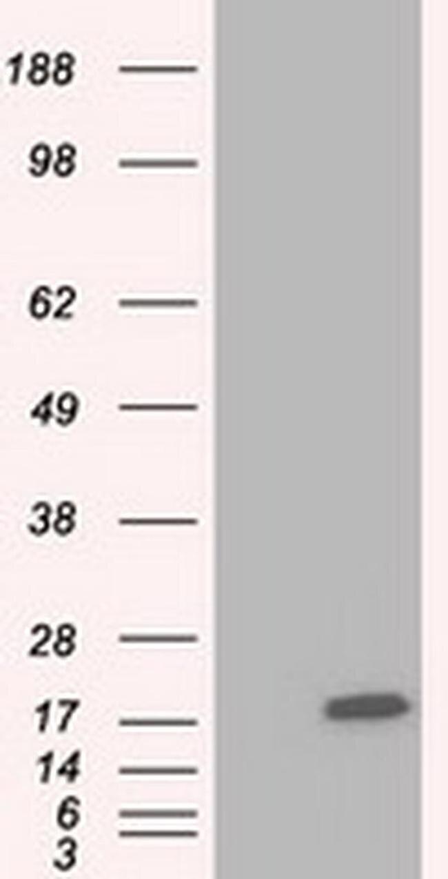 TTC32 Antibody in Western Blot (WB)