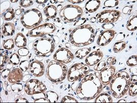 Thromboxane synthase Antibody in Immunohistochemistry (Paraffin) (IHC (P))