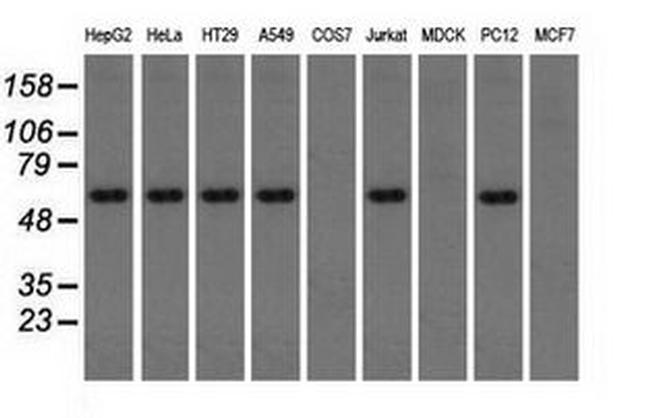 Thromboxane synthase Antibody in Western Blot (WB)