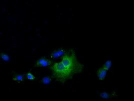 Thromboxane synthase Antibody in Immunocytochemistry (ICC/IF)