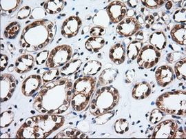 Thromboxane synthase Antibody in Immunohistochemistry (Paraffin) (IHC (P))