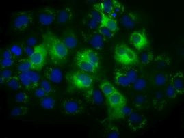 Thromboxane synthase Antibody in Immunocytochemistry (ICC/IF)