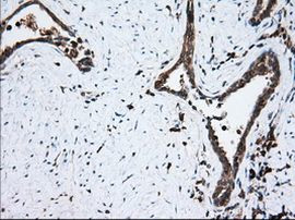 Thromboxane synthase Antibody in Immunohistochemistry (Paraffin) (IHC (P))