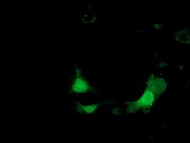 KHK Antibody in Immunocytochemistry (ICC/IF)