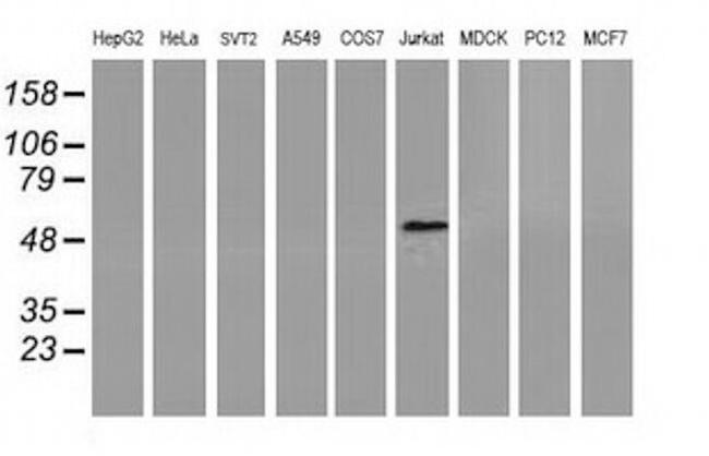 Coronin 1A Antibody in Western Blot (WB)