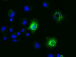 Ephrin A2 Antibody in Immunocytochemistry (ICC/IF)