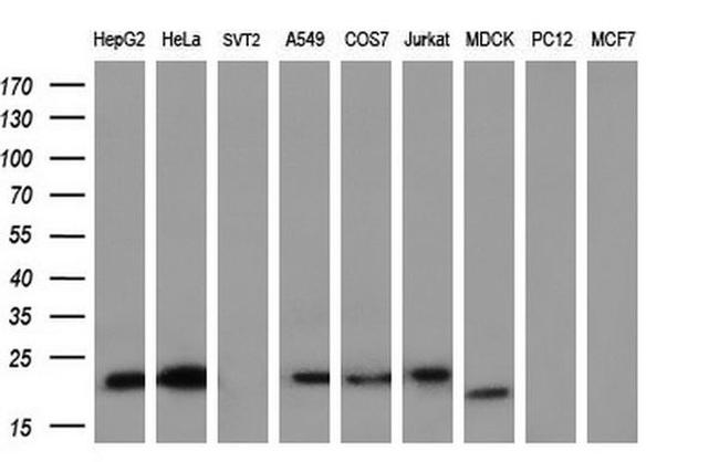 Ephrin A2 Antibody in Western Blot (WB)