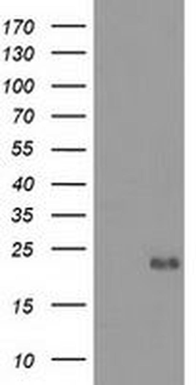 Ephrin A2 Antibody in Western Blot (WB)