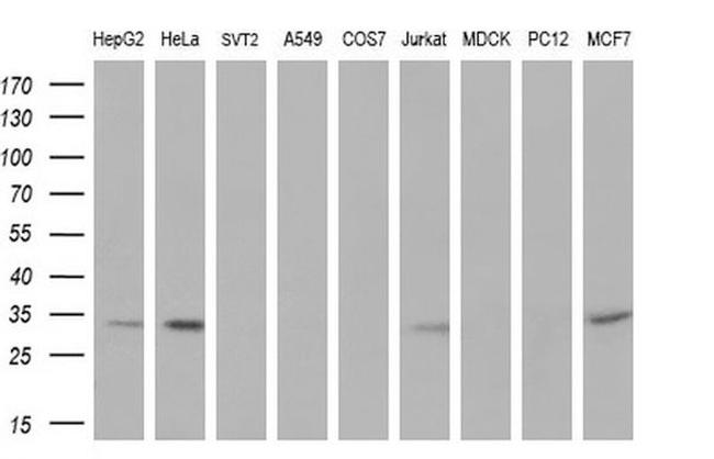 UCK1 Antibody in Western Blot (WB)