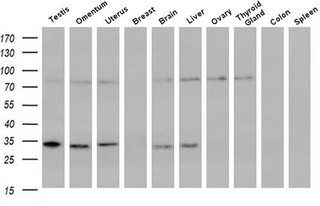 CRYM Antibody in Western Blot (WB)