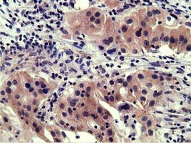 SH3GL1 Antibody in Immunohistochemistry (Paraffin) (IHC (P))