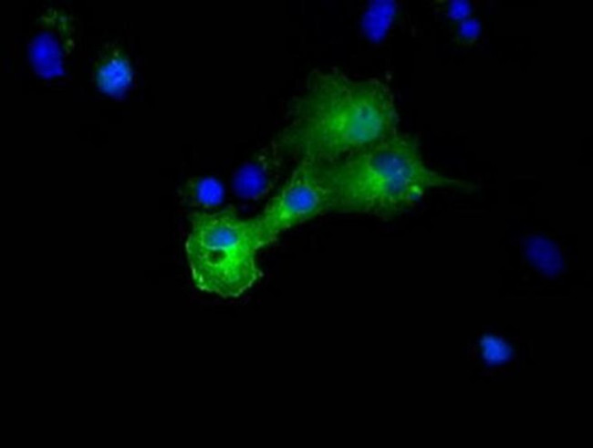 DYNC1LI1 Antibody in Immunocytochemistry (ICC/IF)