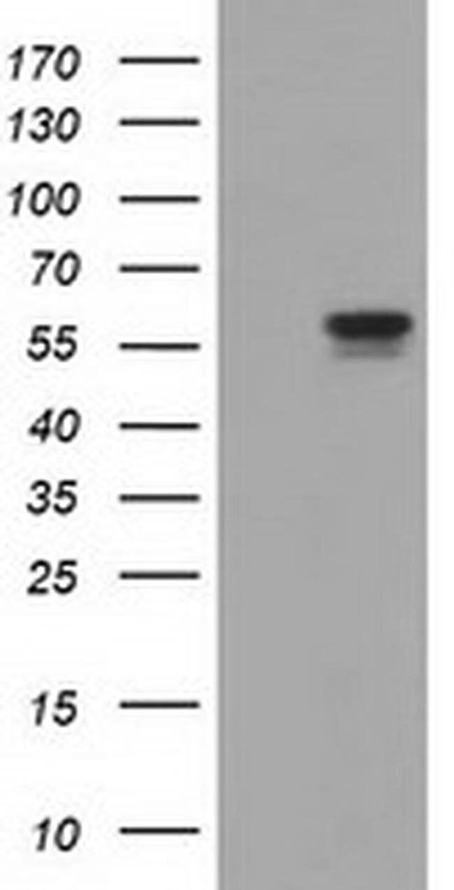 DYNC1LI1 Antibody in Western Blot (WB)