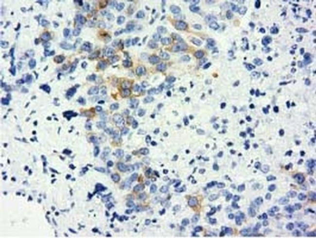 LIN7B Antibody in Immunohistochemistry (Paraffin) (IHC (P))
