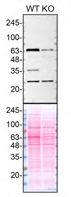 QPRT Antibody in Western Blot (WB)