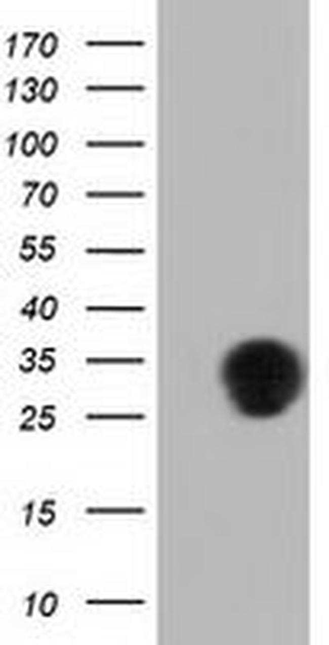 QPRT Antibody in Western Blot (WB)