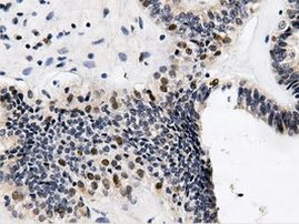 QPRT Antibody in Immunohistochemistry (Paraffin) (IHC (P))