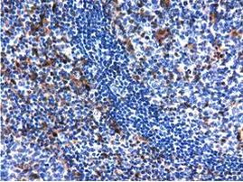 QPRT Antibody in Immunohistochemistry (Paraffin) (IHC (P))