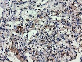 QPRT Antibody in Immunohistochemistry (Paraffin) (IHC (P))