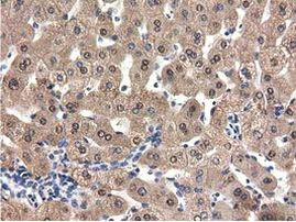 QPRT Antibody in Immunohistochemistry (Paraffin) (IHC (P))