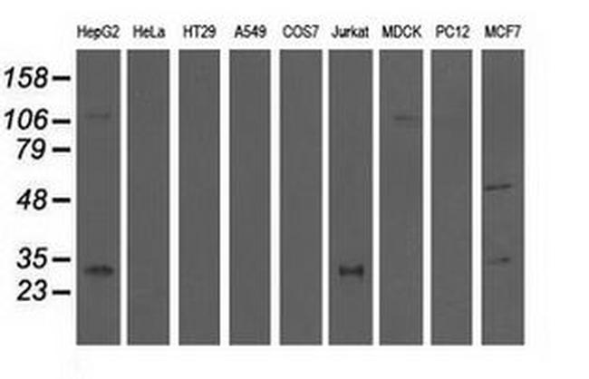 QPRT Antibody in Western Blot (WB)