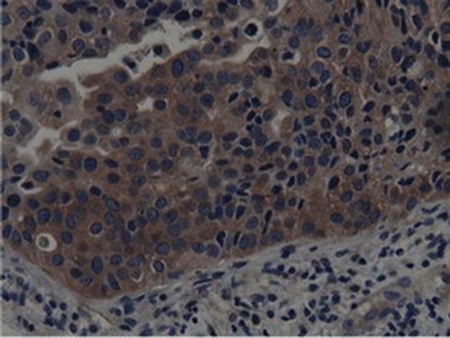 SH3GL1 Antibody in Immunohistochemistry (Paraffin) (IHC (P))