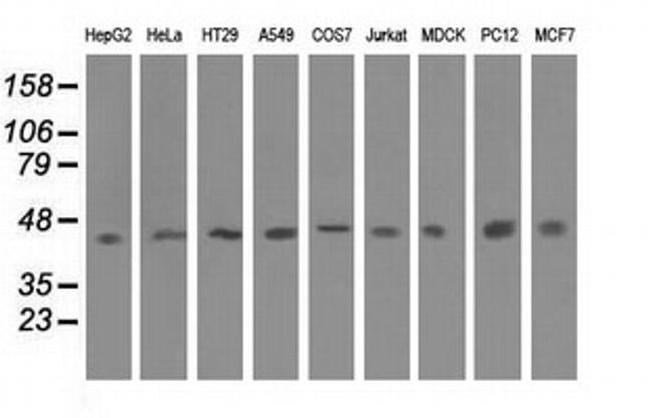 IVD Antibody in Western Blot (WB)