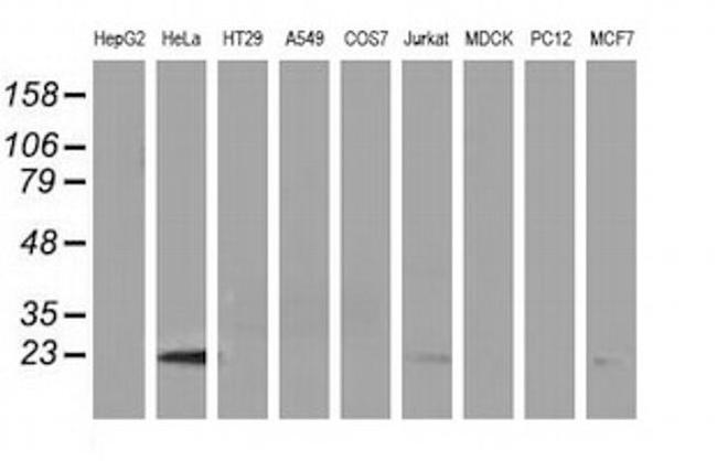 LIN7B Antibody in Western Blot (WB)