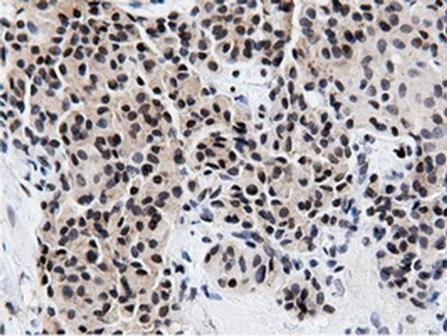 NT5D1 Antibody in Immunohistochemistry (Paraffin) (IHC (P))