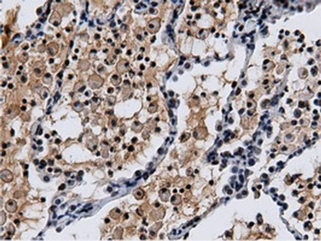 NT5D1 Antibody in Immunohistochemistry (Paraffin) (IHC (P))