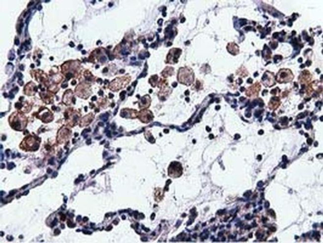 VWA5A Antibody in Immunohistochemistry (Paraffin) (IHC (P))