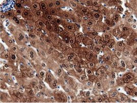 QPRT Antibody in Immunohistochemistry (Paraffin) (IHC (P))