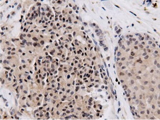 NT5D1 Antibody in Immunohistochemistry (Paraffin) (IHC (P))