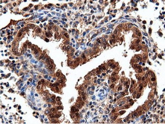 NT5D1 Antibody in Immunohistochemistry (Paraffin) (IHC (P))