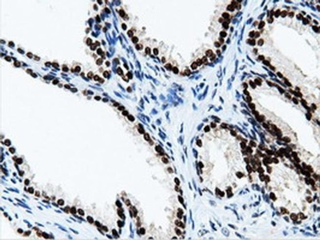 NT5D1 Antibody in Immunohistochemistry (Paraffin) (IHC (P))